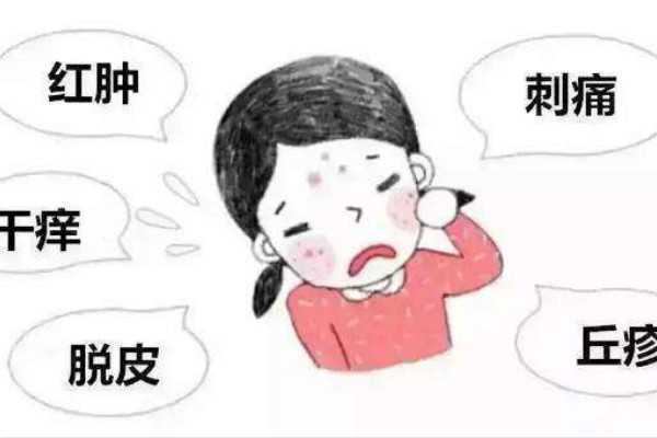 洗面奶过敏有什么症状？什么样子的？