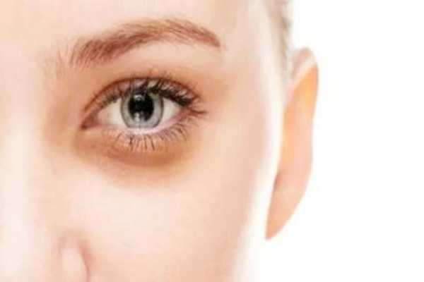 黑眼圈能用眼霜去掉吗 黑眼圈能用遮瑕膏遮住吗