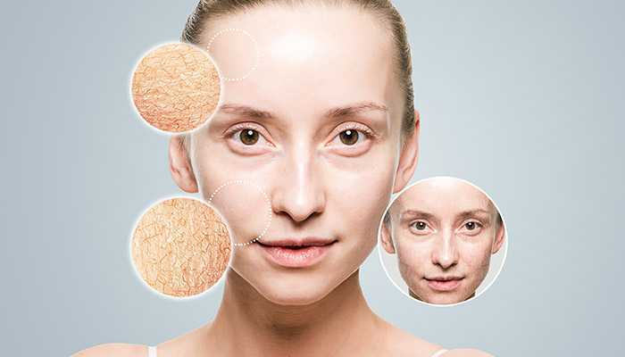 脸上皮肤暗黄粗糙毛孔大怎么办 脸上皮肤暗黄粗糙毛孔大怎么办