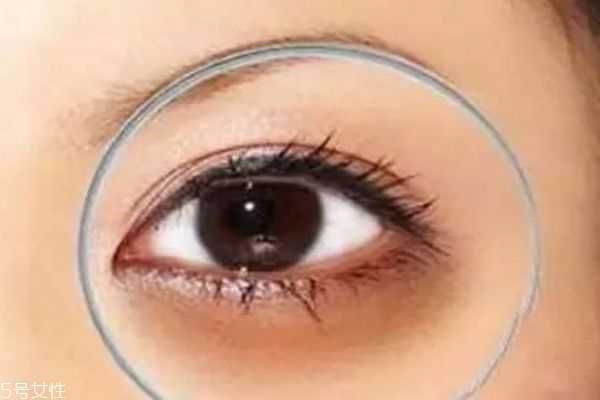 怎样才能有效去除眼袋黑眼圈