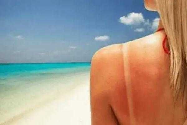 皮肤晒伤后留下黑色素该怎么去除 皮肤晒伤发红擦什么药