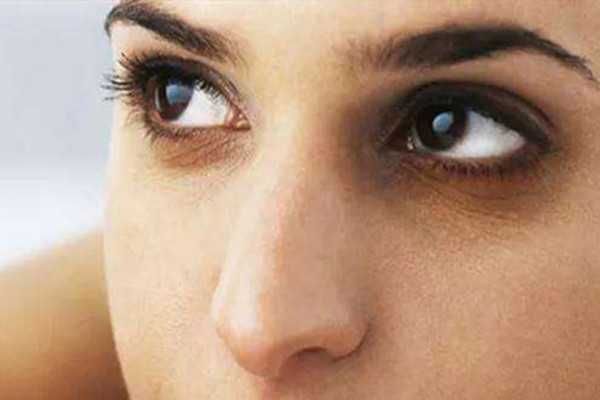 黑眼圈很严重怎么回事