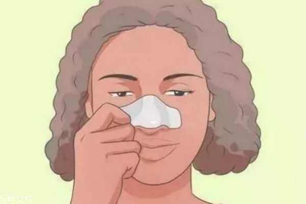 去黑头小窍门有哪些