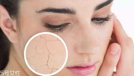 干皮怎么防晒最有效 3步就搞定干皮防晒