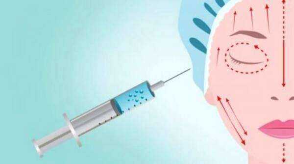 打完玻尿酸多久可以敷面膜 打完玻尿酸多久可以敷面膜