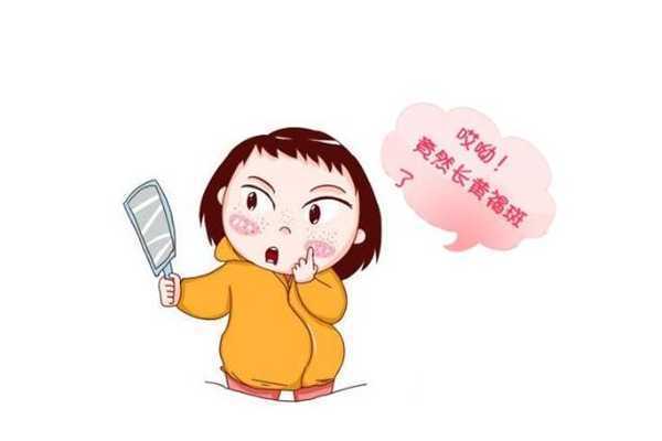 黄褐斑可以自己淡掉吗