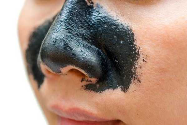 黑头是怎么形成的？