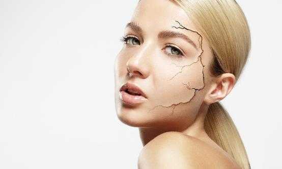 冬季皮肤干燥是怎么回事？皮肤干燥要怎么缓解推荐5大妙招