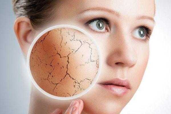 皮肤干燥怎么解决？皮肤干燥是缺什么维生素吗？