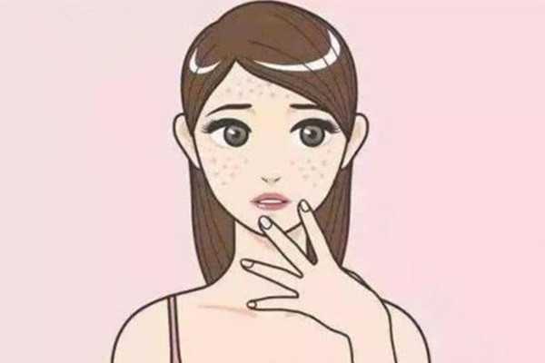 黄褐斑能用药水点掉吗 黄褐斑能用药水点掉吗