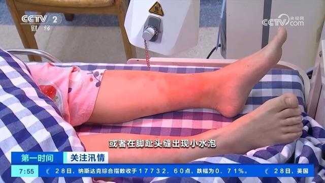 洪涝灾害发生后易感染哪些疾病