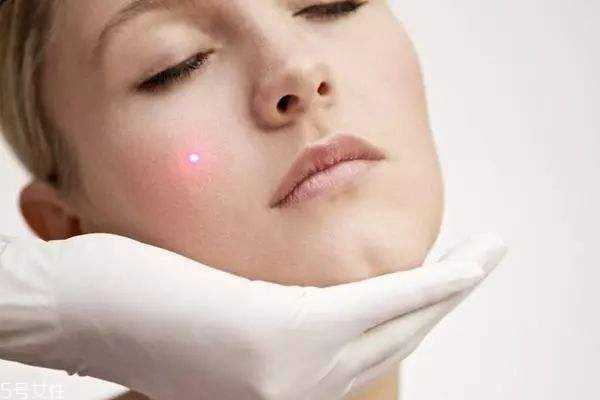 什么痘痘不能挤