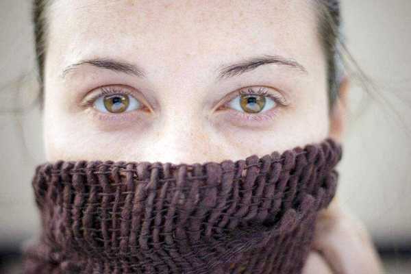 色斑会自己消退吗 色斑会自己消退吗