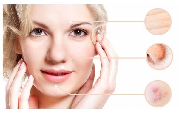 痘痘用什么睡眠面膜好