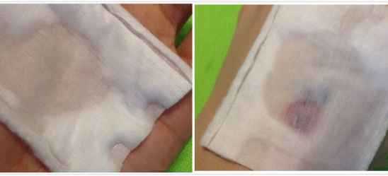 贝德玛卸妆水效果测评湿敷