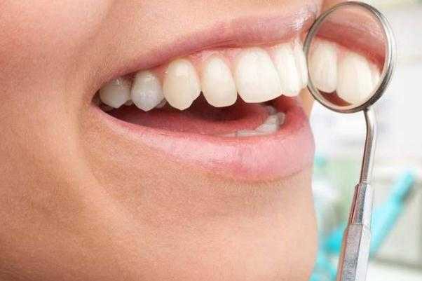 美白牙贴要贴多少分钟？美白牙贴要天天用吗