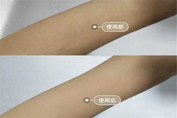 蜜蜡脱毛的坏处是什么 蜜蜡脱毛的坏处是什么