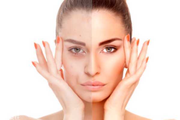 美白产品什么牌子好 十款美白产品让你选