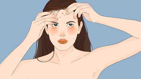 青春痘长在哪些部位