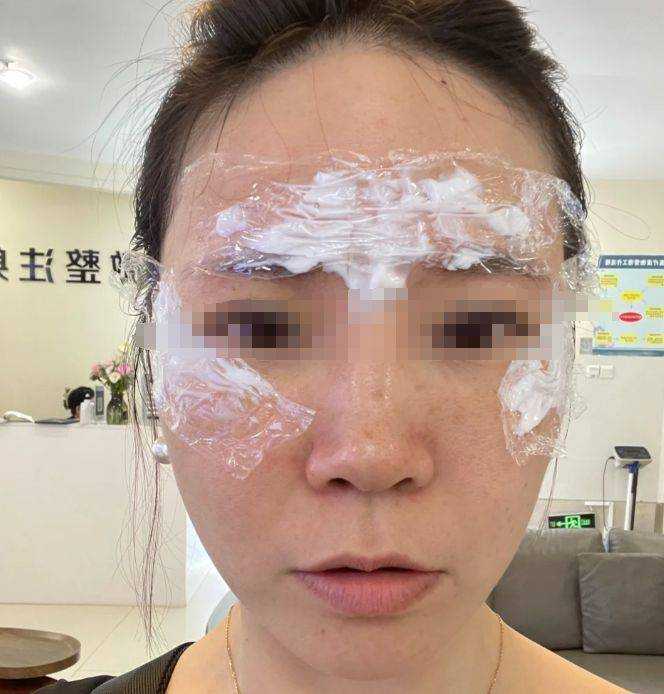 怎样去除皱纹：掌握这4种方法真不容易变老！ 