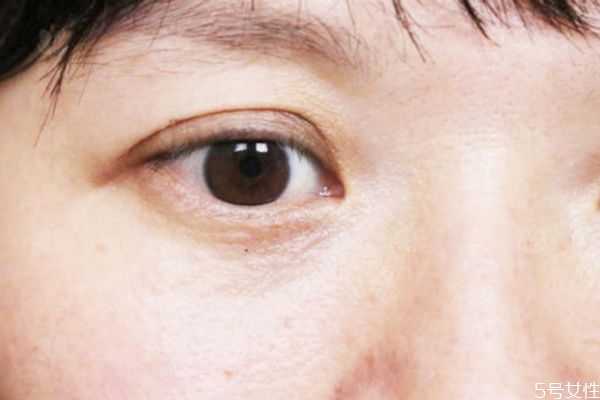 维生素e加凡士林可以去眼纹吗?维生素e加凡士林要洗吗