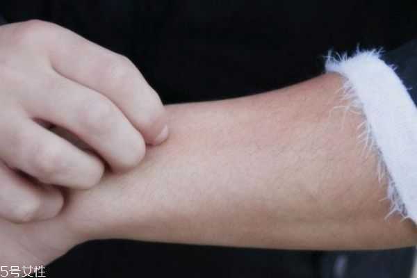 一到冬天皮肤就发痒是皮肤病吗 一到冬天皮肤就发痒是皮肤病吗