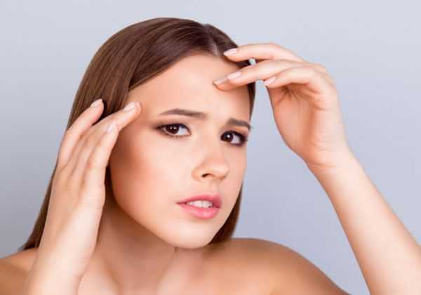 粉刺是怎么形成的 粉刺是怎么形成的