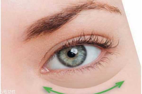 眼袋严重怎么解决