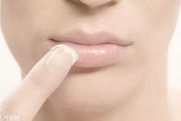 嘴唇为什么干燥