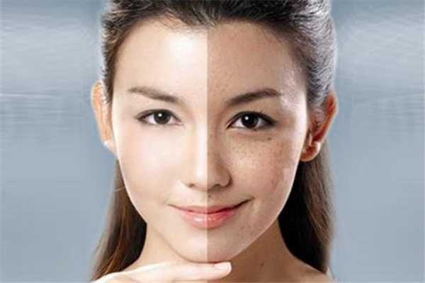 脸上的肌肤真的需要抗糖化吗？抗糖对肌肤到底有没有用