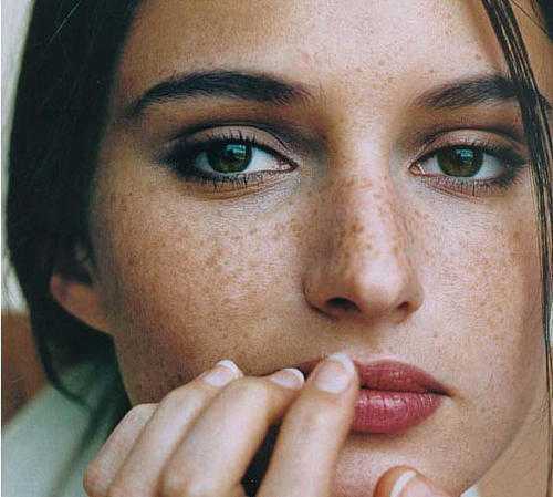 为什么女生会长麻子?女生长麻子的原因是什么 为什么女生会长麻子?女生长麻子的原因是什么