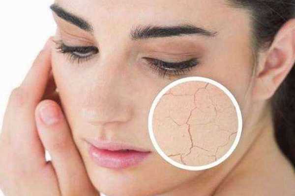 油性皮肤的九大好处 油性皮肤的九大好处