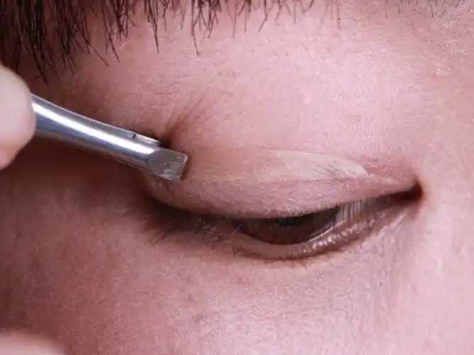 双眼皮贴的胶留在眼皮上怎么卸