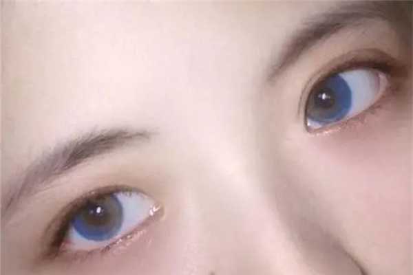 美瞳买回来可以直接佩戴吗 美瞳买回来可以直接佩戴吗