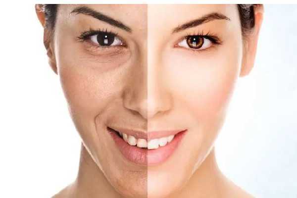 皮肤晒红了应该怎么处理