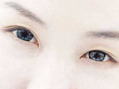 眼袋要怎么去除效果才会变得更好 眼袋要怎么去除效果才会变得更好