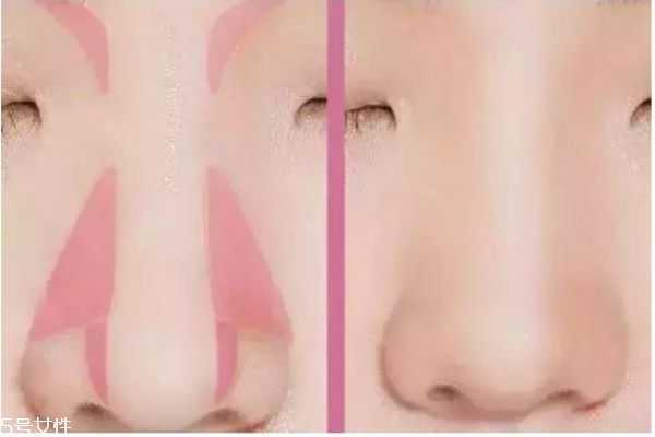 鼻子塌怎么化妆