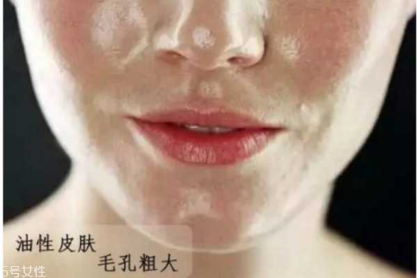 怎么判断自己什么肤质 油皮应该如何护肤