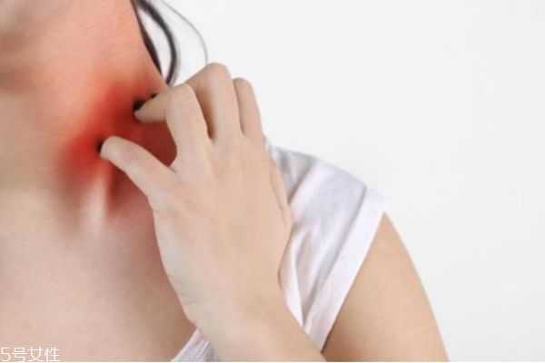 秋季皮肤干燥过敏痒怎么办