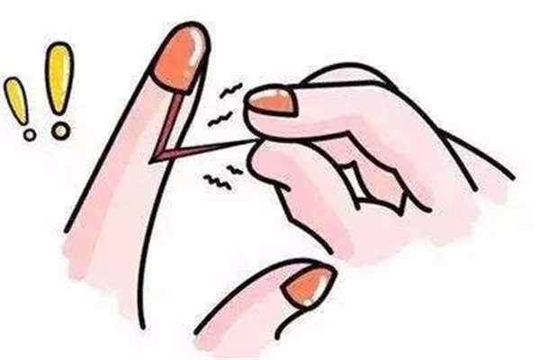 手长倒刺是什么原因造成的 手长倒刺是什么原因造成的