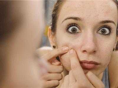 如何彻底根治脸上顽固的粉刺