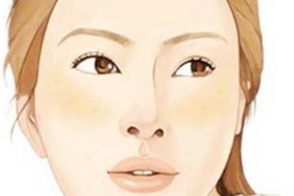 黄褐斑能用药水点掉吗 黄褐斑能用药水点掉吗