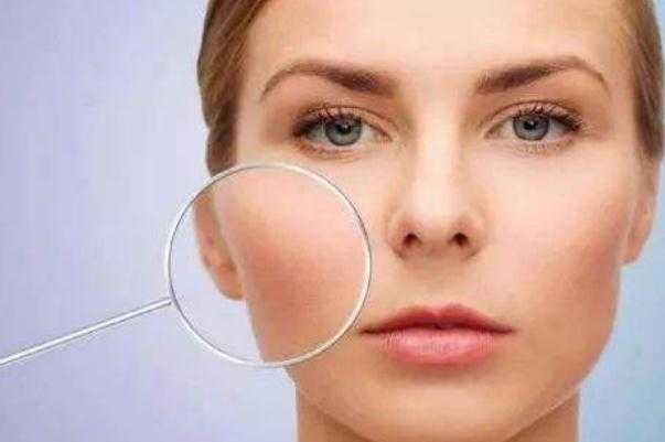 收缩毛孔是果酸好还是水杨酸好