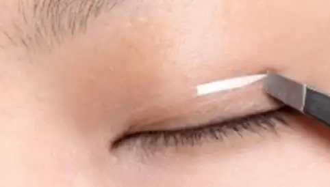 双眼皮贴有哪些类型