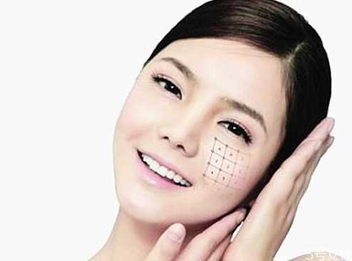 热玛吉可以去颈纹吗？热玛吉效果能维持多久