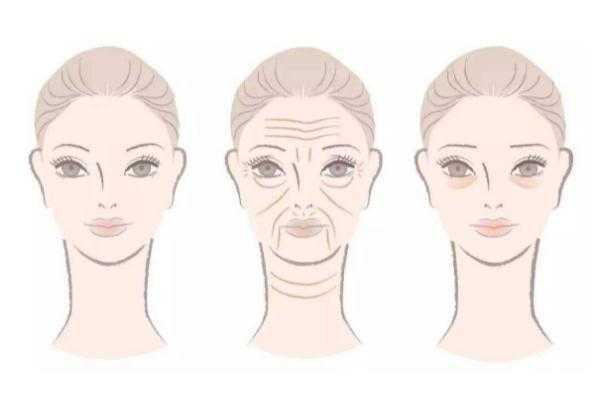 皱纹怎么样才能去掉 皱纹是什么原因造成的 皱纹怎么样才能去掉 皱纹是什么原因造成的