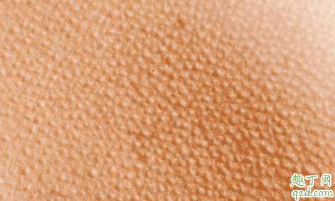 维a酸乳膏去鸡皮肤效果好吗 维a酸乳膏去鸡皮肤效果好吗