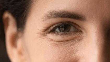 眼部皮肤干燥怎么办