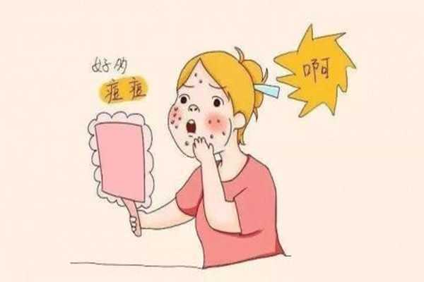 痘痘挤了之后怎么处理 痘痘挤了之后怎么处理