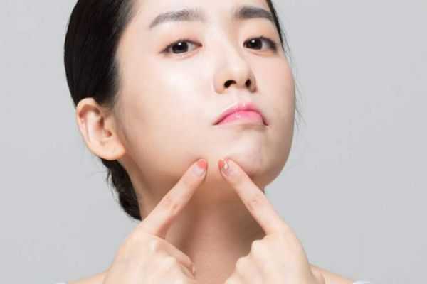 女生下巴长痘的原因有什么 为什么女生下巴会长痘